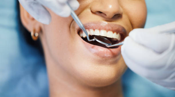 Best Pediatric Emergency Dentist in Cathcart, WA